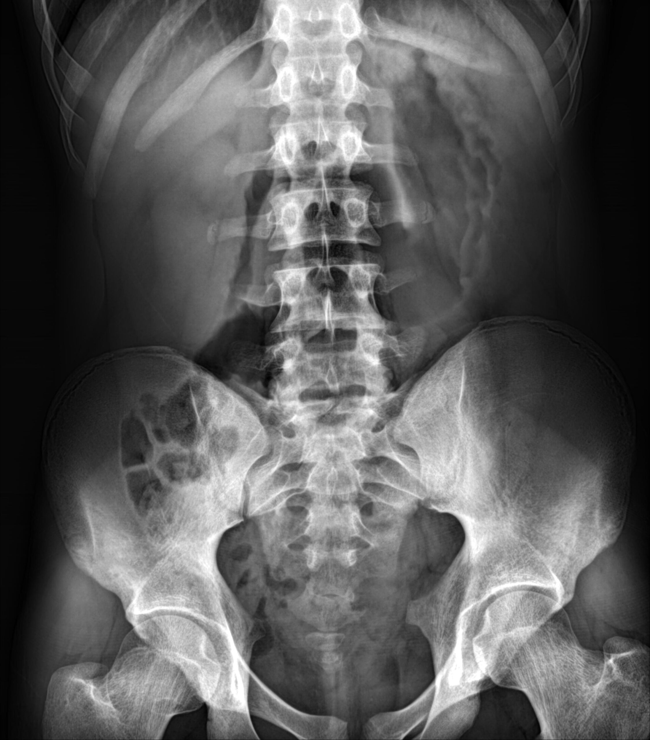 Barium Contrast Studies