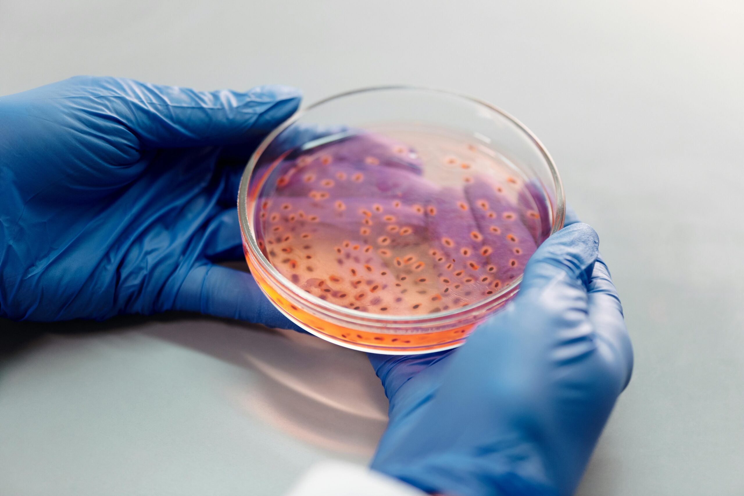Infection Control Department