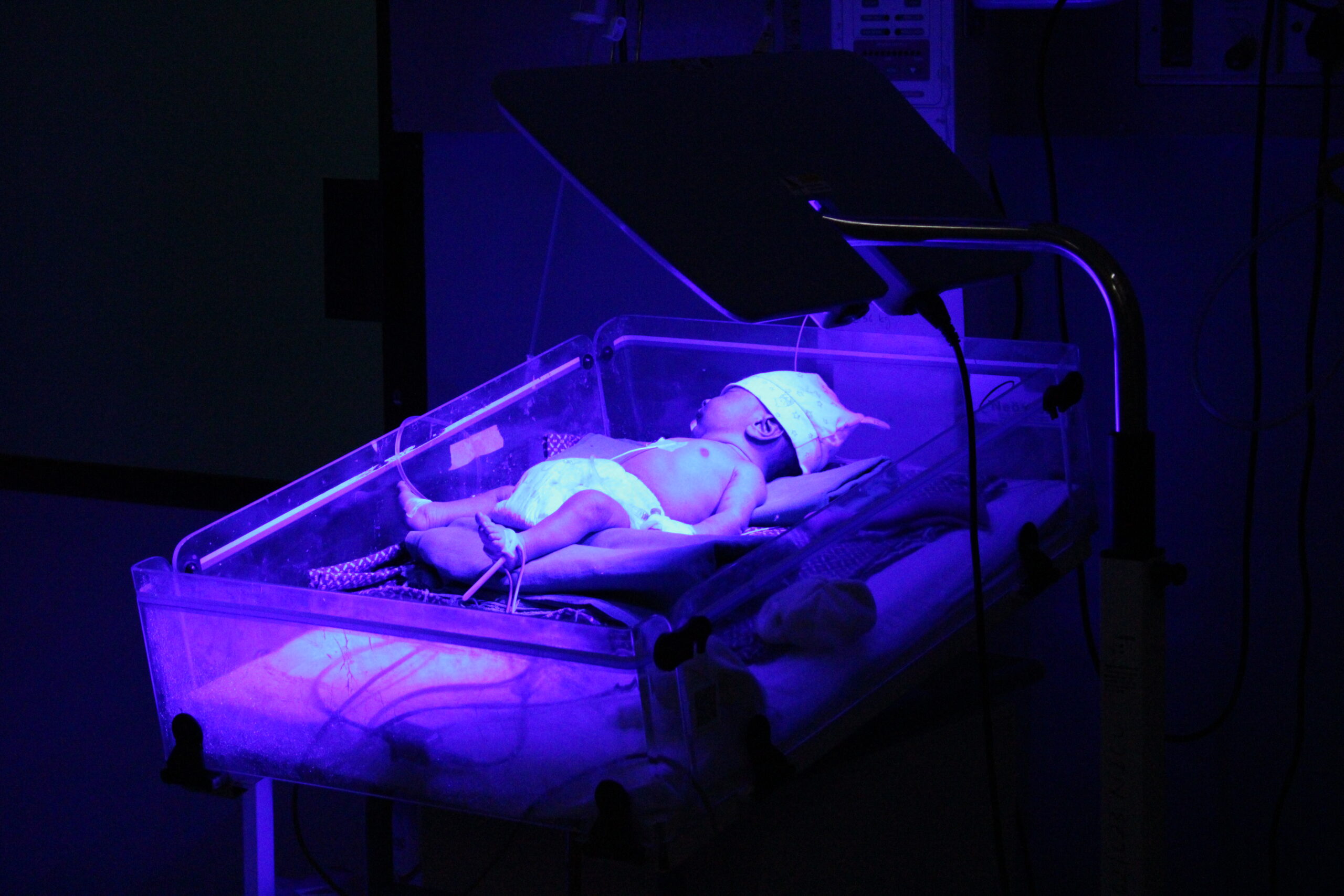 NICU