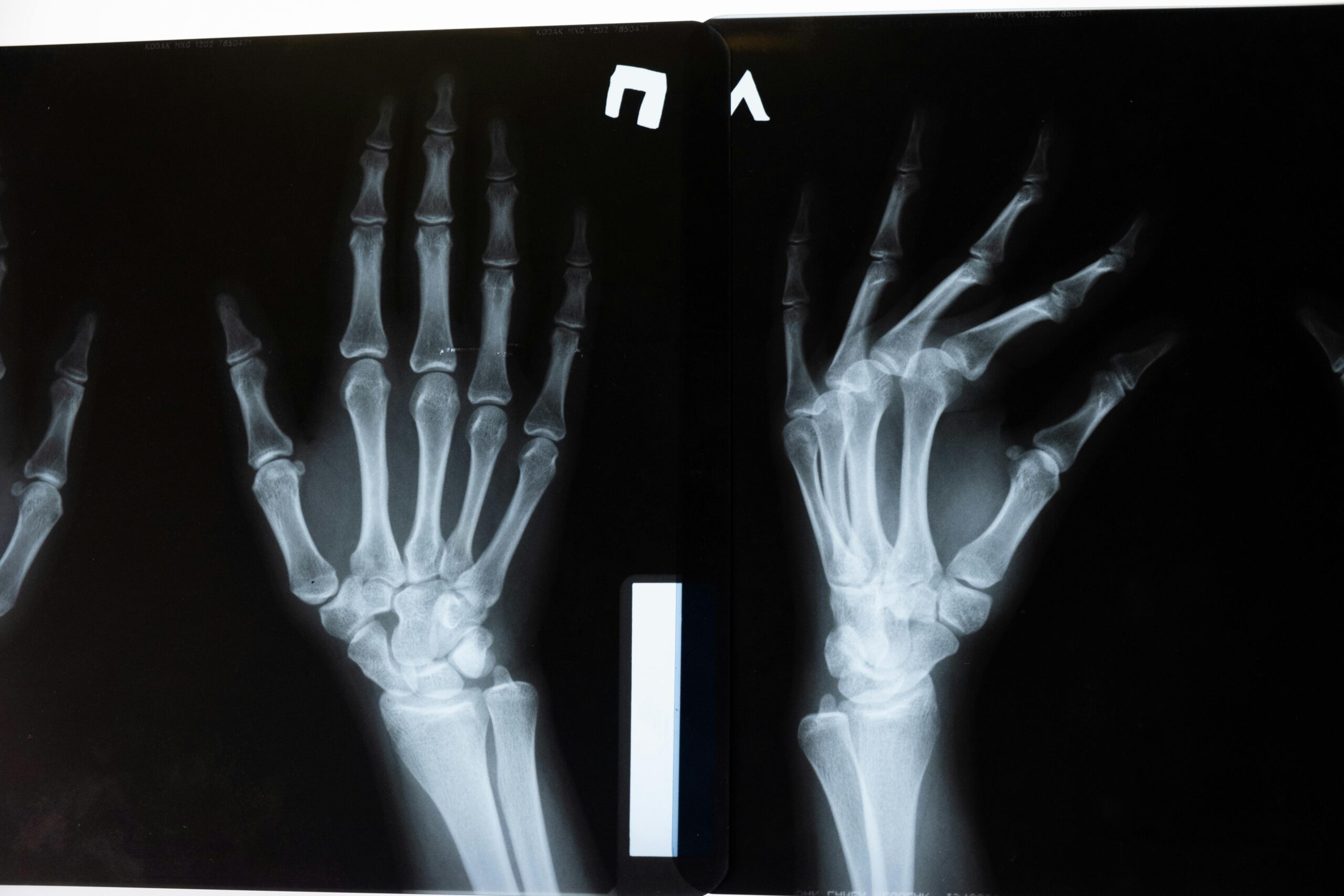 Ortho OT
